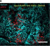 Fig.6.A showing Immunohistochemistry in a Mus musculus (House mouse) sample from the publication: TGFβ blocks IFNα/β release and tumor rejection in spontaneous mammary tumors.