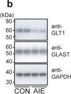 Fig.3.B showing Western Blotting from the publication: Glutamatergic dysfunction of astrocytes in paraventricular nucleus of thalamus contributes to adult anxiety susceptibility in adolescent ethanol exposed mice.