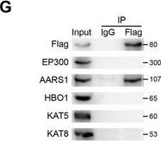 Fig.1.G showing Western Blotting in an Oryctolagus cuniculus (Rabbit) sample from the publication: ASH2L-K312-Lac Stimulates Angiogenesis in Tumors to Expedite the Malignant Progression of Hepatocellular Carcinoma.