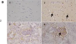 Fig.7.B showing Immunohistochemistry from the publication: Indoxyl Sulfate Affects Glial Function Increasing Oxidative Stress and Neuroinflammation in Chronic Kidney Disease: Interaction between Astrocytes and Microglia.