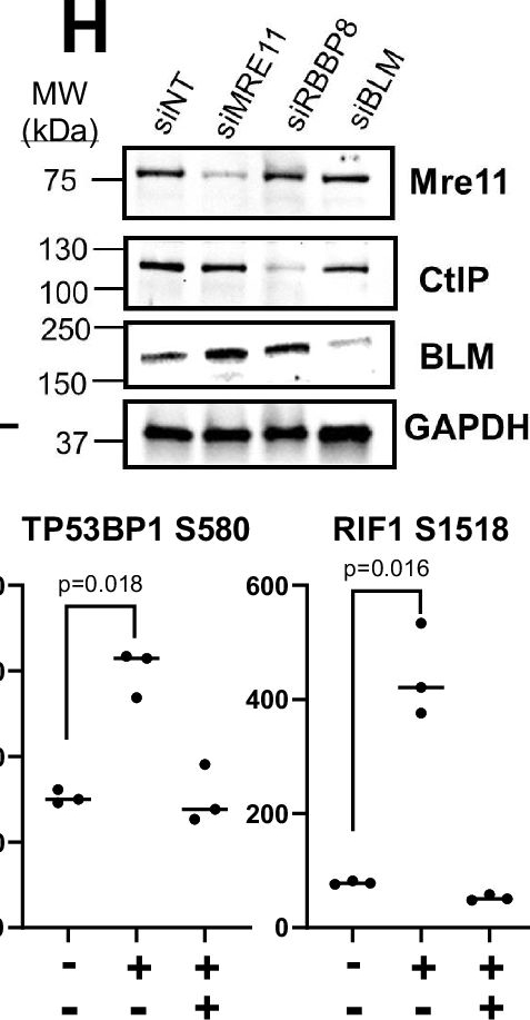 Fig.6.H showing Western Blotting in a Homo sapiens (Human) sample from the publication: ATM inhibition exploits checkpoint defects and ATM-dependent double strand break repair in TP53-mutant glioblastoma.