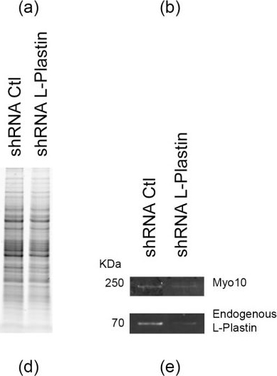 Fig.4.A showing Western Blotting from the publication: Myosin-X Acts Upstream of L-Plastin to Drive Stress-Induced Tunneling Nanotubes.