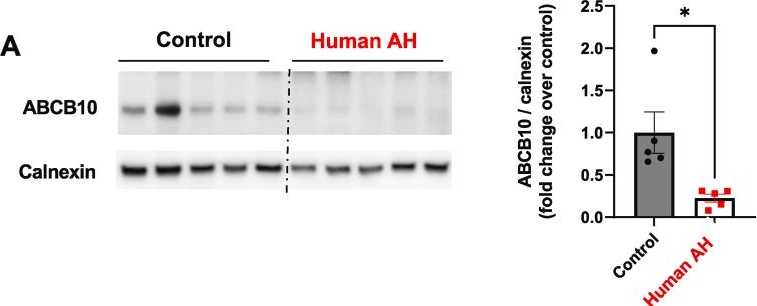 Fig.1.A showing Western Blotting from the publication: The mitochondrial biliverdin exporter ABCB10 in hepatocytes mitigates neutrophilic inflammation in alcoholic hepatitis.