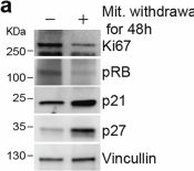 Fig.1.A showing Western Blotting in a Homo sapiens (Human) sample from the publication: Transient APC/C inactivation by mTOR boosts glycolysis during cell cycle entry.