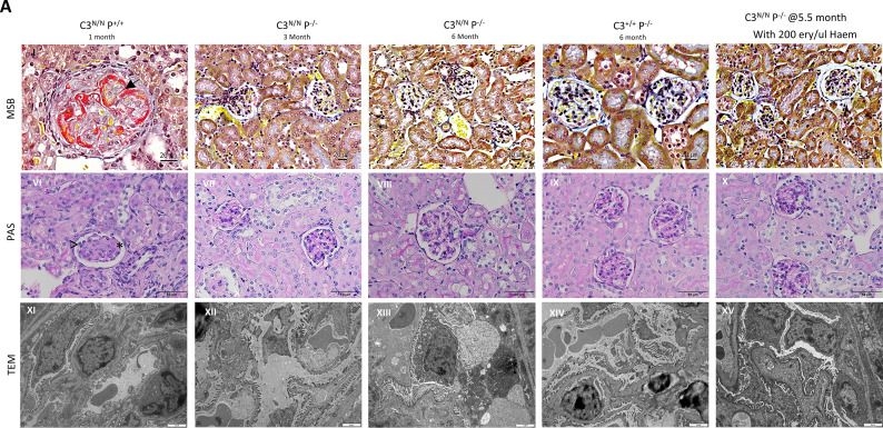 Fig.2.A showing Immunohistochemistry in a Mus musculus (House mouse) sample from the publication: Properdin deficiency or anti-properdin treatment ameliorates disease in the C3 gain-of-function mouse model of atypical haemolytic uraemic syndrome.