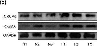 Fig.1.B showing Western Blotting from the publication: Inhibiting CXCR6 promotes senescence of activated hepatic stellate cells with limited proinflammatory SASP to attenuate hepatic fibrosis.