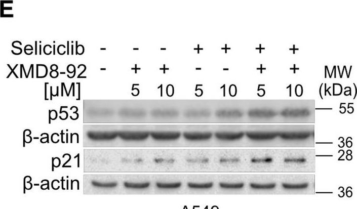 Fig.2.E showing Western Blotting from the publication: ERK5 suppression overcomes FAK inhibitor resistance in mutant KRAS-driven non-small cell lung cancer.