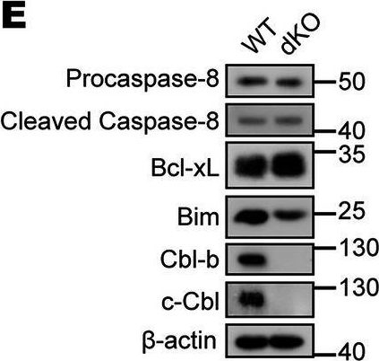 Fig.2.E showing Western Blotting in a Mus musculus (House mouse) sample from the publication: E3 Ubiquitin ligases Cbl-b and c-Cbl maintain the homeostasis of macrophages by regulating the M-CSF/M-CSFR signaling axis.