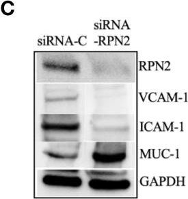 Fig.6.C showing Western Blotting from the publication: Lysine in Combination With Estradiol Promote Dissemination of Estrogen Receptor Positive Breast Cancer via Upregulation of U2AF1 and RPN2 Proteins.