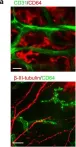 Fig.5.A showing Immunohistochemistry-immunofluorescence in a Mus musculus (House mouse) sample from the publication: Antibiotic-induced dysbiosis of gut microbiota impairs corneal development in postnatal mice by affecting CCR2 negative macrophage distribution.