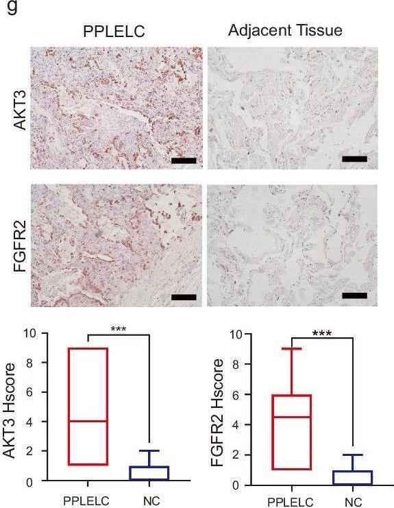 Fig.2.G showing Immunohistochemistry from the publication: Single-cell analysis reveals transcriptomic features and therapeutic targets in primary pulmonary lymphoepithelioma-like carcinoma.