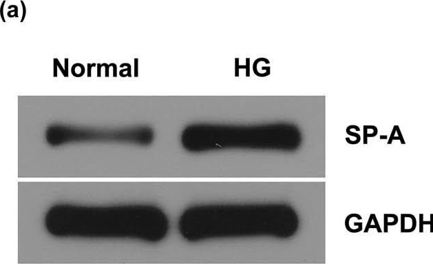 Fig.6.A showing Western Blotting from the publication: LncRNA CASC15 inhibition relieves renal fibrosis in diabetic nephropathy through down-regulating SP-A by sponging to miR-424.