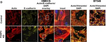 Fig.7.D showing Immunocytochemistry-immunofluorescence in a Homo sapiens (Human) sample from the publication: FOXP3 and miR-155 cooperate to control the invasive potential of human breast cancer cells by down regulating ZEB2 independently of ZEB1.