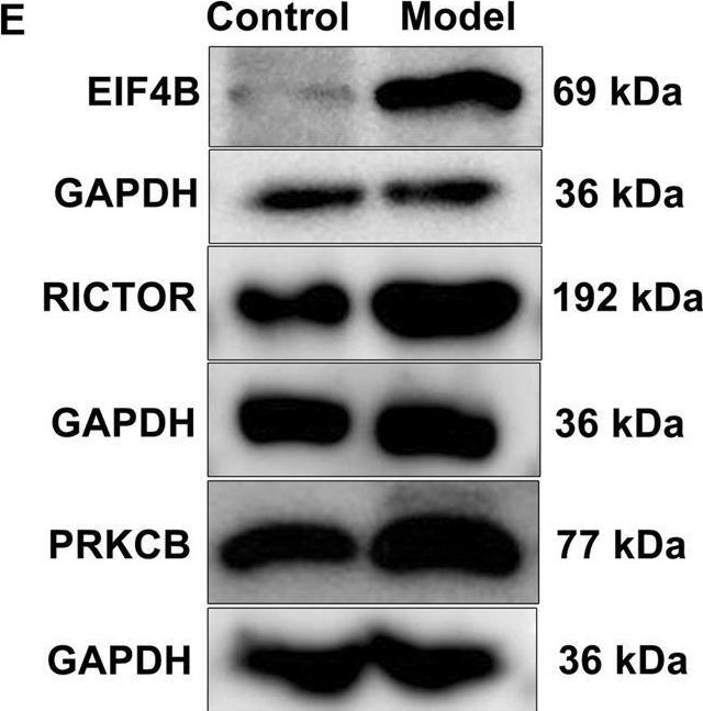 Fig.9.M showing Western Blotting from the publication: Single-Cell RNA Sequencing Profiles Identify Important Pathophysiologic Factors in the Progression of Diabetic Nephropathy.