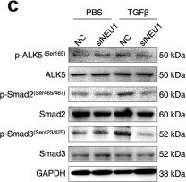 Fig.7.C showing Western Blotting from the publication: Neuraminidase 1 promotes renal fibrosis development in male mice.