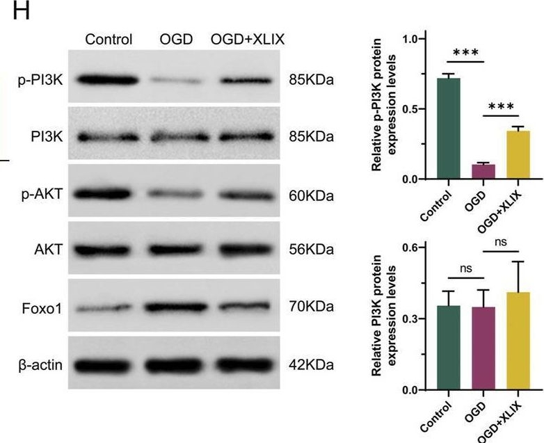 Fig.2.H showing Western Blotting from the publication: Gypenoside XLIX inhibiting PI3K/AKT/FOXO1 signaling pathway mediated neuronal mitochondrial autophagy to improve patients with ischemic stroke.