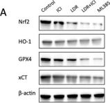 xCT/SLC7A11 (D2M7A) Rabbit mAb | Cell Signaling Technology