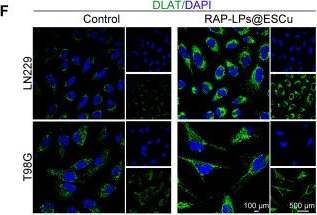 Fig.4.F showing Immunocytochemistry-immunofluorescence from the publication: Engineered RAP-anchored copper-escorting liposomes for FDX1-targeted cuproptosis in glioblastoma therapy‌.