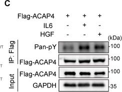 Fig.4.C from the publication: Kupffer Cell-derived IL6 Promotes Hepatocellular Carcinoma Metastasis Via the JAK1-ACAP4 Pathway.