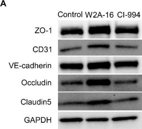Fig.3.A showing Western Blotting in a Homo sapiens (Human) sample from the publication: A novel histone deacetylase inhibitor W2A-16 improves the barrier integrity in brain vascular endothelial cells.