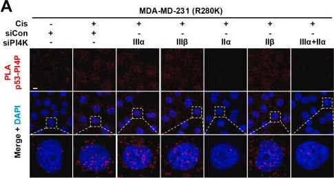 Fig.4.A showing Immunocytochemistry-immunofluorescence in a Mus musculus (House mouse) sample from the publication: Lipid transfer proteins and PI4KIIα initiate nuclear p53-phosphoinositide signaling.