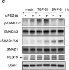 Fig.5.C showing Western Blotting from the publication: TGF-β signalling and PEG10 are mutually exclusive and inhibitory in chondrosarcoma cells.