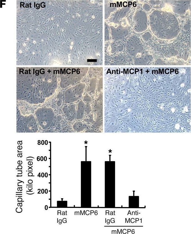 Fig.6.F showing Immunohistochemistry in a Mus musculus (House mouse) sample from the publication: Mast cell hyperactivity underpins the development of oxygen-induced retinopathy.