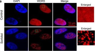 Fig.3.A showing Immunocytochemistry-immunofluorescence from the publication: A Site-Specific Self-Association of a Protein Hub Drives Its Phase Separation.