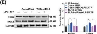Fig.1.E showing Western Blotting in a Mus musculus (House mouse) sample from the publication: Polydatin alleviates mitochondrial damage and apoptosis of lung epithelial cells by inhibiting toll-like receptor 4-dependent macrophage activation in asthma.
