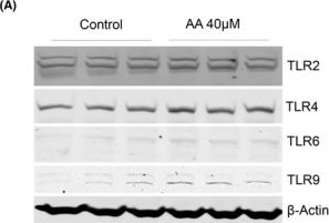 Fig.3.A showing Western Blotting from the publication: Aristolochic acid I induces proximal tubule injury through ROS/HMGB1/mt DNA mediated activation of TLRs.