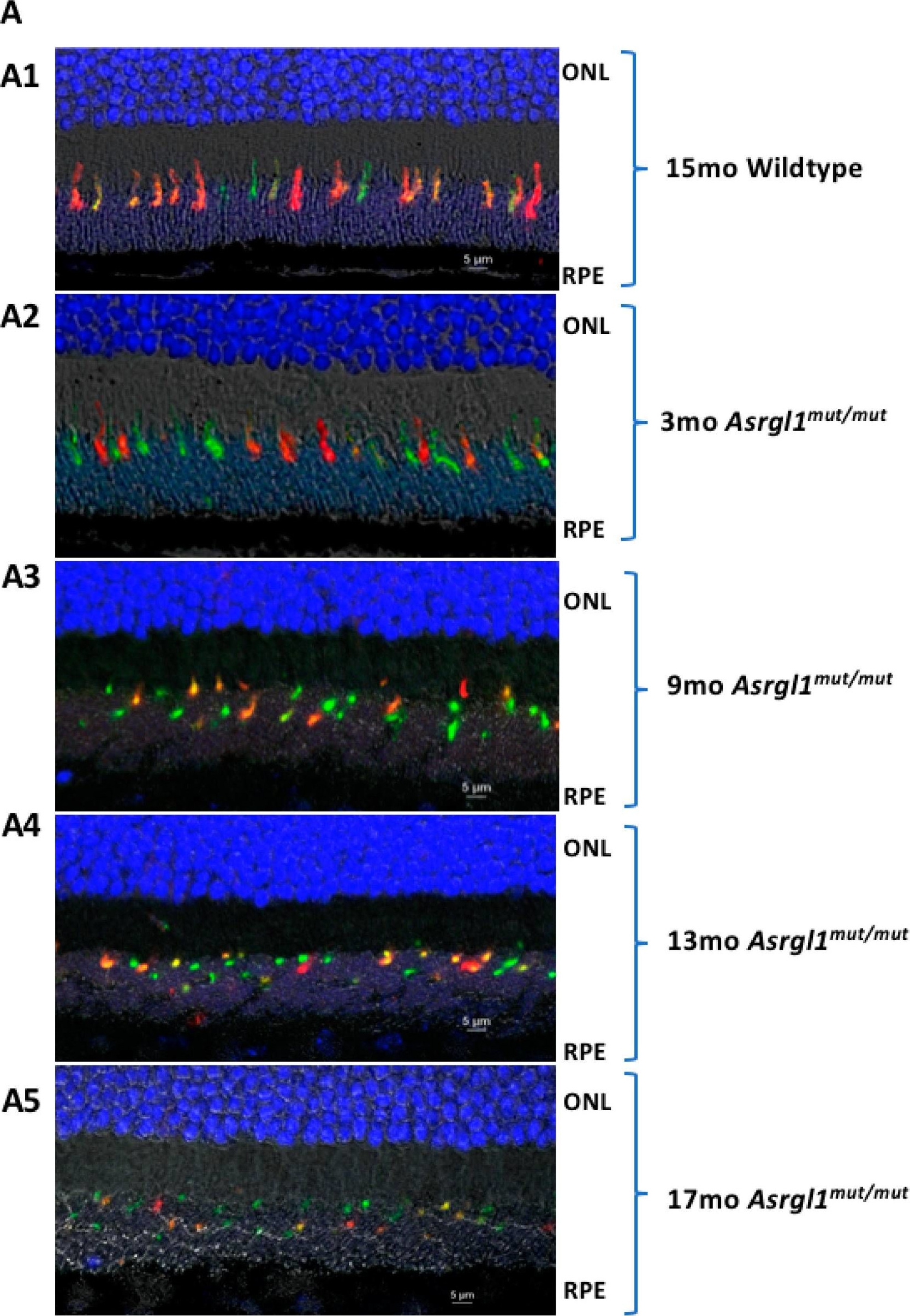 Fig.5.A showing Immunohistochemistry in a Mus musculus (House mouse) sample from the publication: A Mouse Model with Ablated Asparaginase and Isoaspartyl Peptidase 1 (Asrgl1) Develops Early Onset Retinal Degeneration (RD) Recapitulating the Human Phenotype.