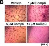 Fig.4.B showing Immunohistochemistry-paraffin in a Mus musculus (House mouse) sample from the publication: Compound C Inhibits B16-F1 Tumor Growth in a Syngeneic Mouse Model Via the Blockage of Cell Cycle Progression and Angiogenesis.