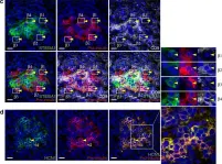 Fig.3.C showing Immunohistochemistry-immunofluorescence in a Homo sapiens (Human) sample from the publication: Human islets contain four distinct subtypes of β cells.