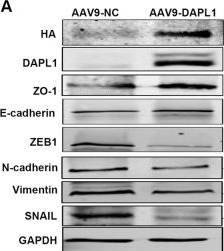 Fig.2.A showing Western Blotting in a Mus musculus (House mouse) sample from the publication: DAPL1 prevents epithelial-mesenchymal transition in the retinal pigment epithelium and experimental proliferative vitreoretinopathy.