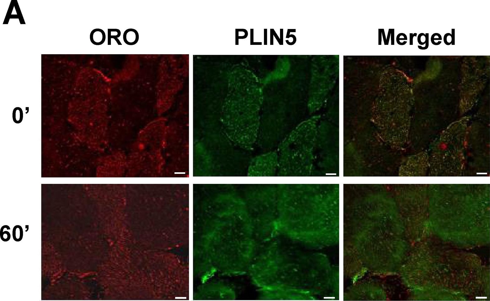 Cellular localization and associations of the major lipolytic proteins in human skeletal muscle at rest and during exercise.