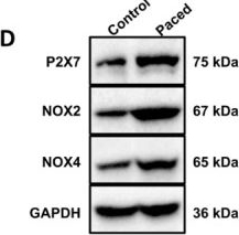 Fig.3.D showing Western Blotting in a Rattus norvegicus (Rat) sample from the publication: P2X7 receptors promote atrial remodeling and atrial fibrillation susceptibility via reactive oxygen species-mediated mitogen-activated protein kinase signaling activation.