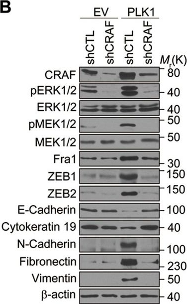 Fig.7.B showing Western Blotting in a Homo sapiens (Human) sample from the publication: Polo-like kinase 1 induces epithelial-to-mesenchymal transition and promotes epithelial cell motility by activating CRAF/ERK signaling.