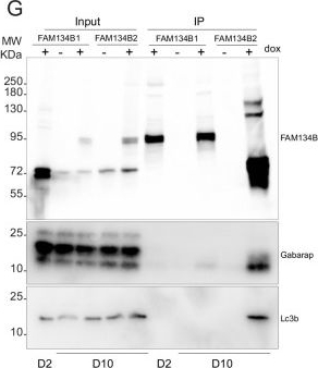 Fig.10.G showing Western Blotting in a Mus musculus (House mouse) sample from the publication: Two FAM134B isoforms differentially regulate ER dynamics during myogenesis.