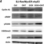 Fig.5.D showing Western Blotting in a Homo sapiens (Human) sample from the publication: MYC and RAS are unable to cooperate in overcoming cellular senescence and apoptosis in normal human fibroblasts.