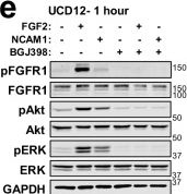 Fig.6.E showing Western Blotting from the publication: Brain FGF2 and NCAM1 contribute to FGFR1-dependent progression of estrogen receptor-positive breast cancer brain metastases.
