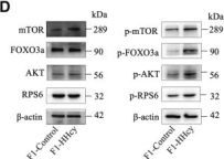 FoxO3a (D19A7) Rabbit Monoclonal Antibody | Cell Signaling Technology