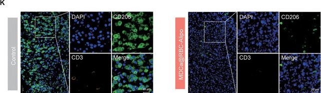 Fig.5.K showing Immunohistochemistry-immunofluorescence in a Mus musculus (House mouse) sample from the publication: Targeting Splenic Myeloid Cells with Nanobiologics to Prevent Postablative Pancreatic Cancer Recurrence via Inducing Antitumor Peripheral Trained Immunity.