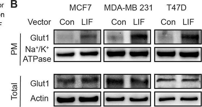 Fig.4.X showing Western Blotting from the publication: Leukemia inhibitory factor drives glucose metabolic reprogramming to promote breast tumorigenesis.