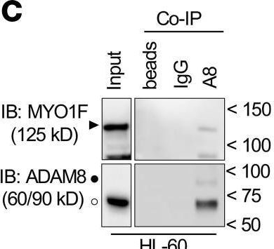 Fig.2.C showing Western Blotting in a Homo sapiens (Human) sample from the publication: ADAM8 signaling drives neutrophil migration and ARDS severity.