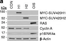 Fig.6.A showing Western Blotting from the publication: Mapping H4K20me3 onto the chromatin landscape of senescent cells indicates a function in control of cell senescence and tumor suppression through preservation of genetic and epigenetic stability.