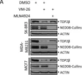 Fig.1.A showing Western Blotting in a Homo sapiens (Human) sample from the publication: SCFβ-TrCP-mediated degradation of TOP2β promotes cancer cell survival in response to chemotherapeutic drugs targeting topoisomerase II.