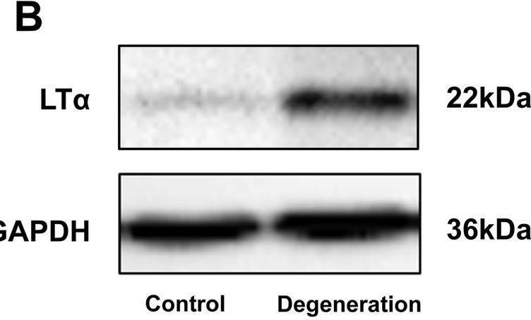 Fig.1.B showing Western Blotting in a Homo sapiens (Human) sample from the publication: Elevated lymphotoxin-α (TNFβ) is associated with intervertebral disc degeneration.