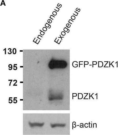 Fig.6.A showing Western Blotting from the publication: SR-BI Mediated Transcytosis of HDL in Brain Microvascular Endothelial Cells Is Independent of Caveolin, Clathrin, and PDZK1.