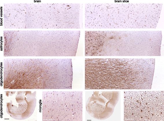 An advanced glioma cell invasion assay based on organotypic brain slice cultures.