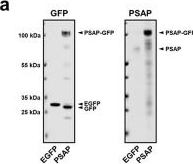 Fig.1.A showing Western Blotting from the publication: Prosaposin Reduces α-Synuclein in Cells and Saposin C Dislodges it from Glucosylceramide-enriched Lipid Membranes.
